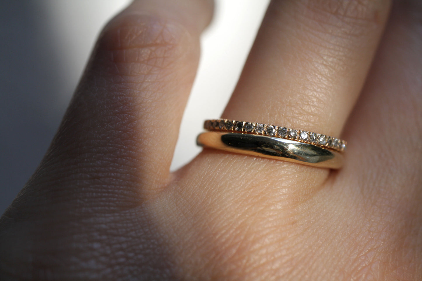 Anillo Domo